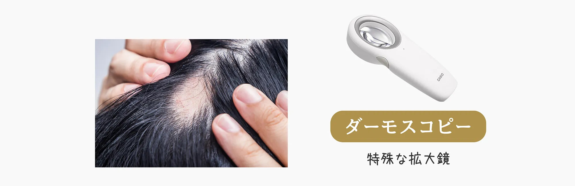 診断方法1 ダーモスコピーを使用した方法