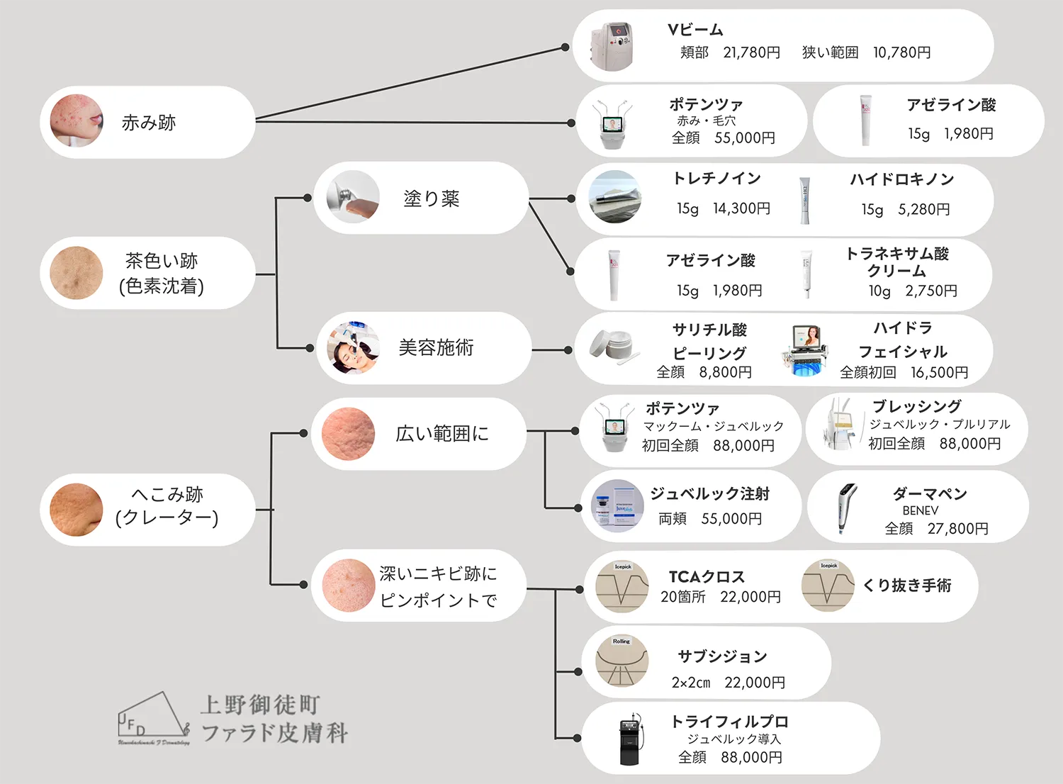 ニキビ跡治療のフローチャート図