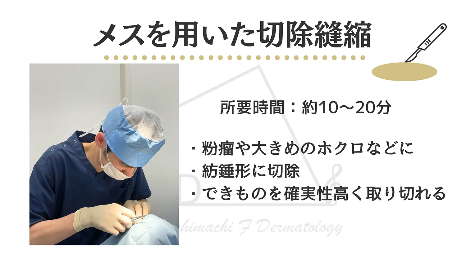 メスを用いた切除縫縮