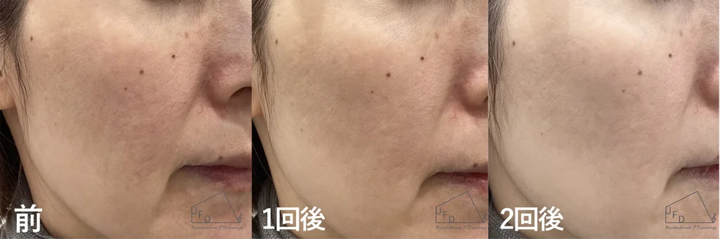 症例1 【40歳代女性】