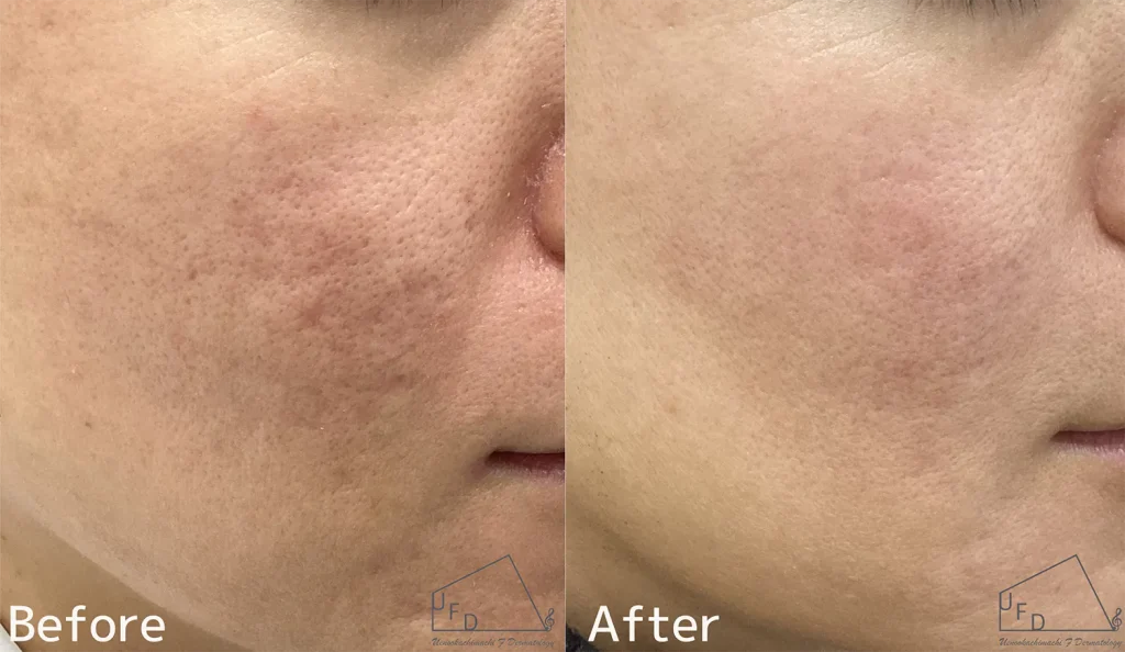 症例2 【40歳代男性】