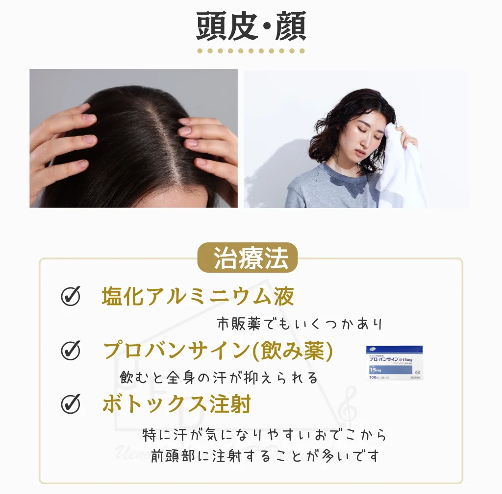 頭皮・顔汗の治療法