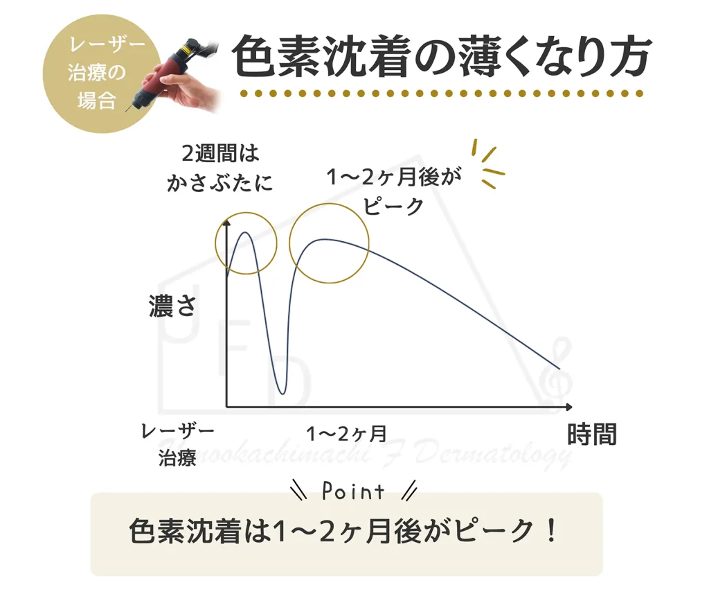 色素沈着をレーザーで治療した場合の回復過程を説明した図