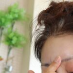 しわ治療・しわ取り｜おでこのしわ、目の下のしわなど皮膚科の治療を解説