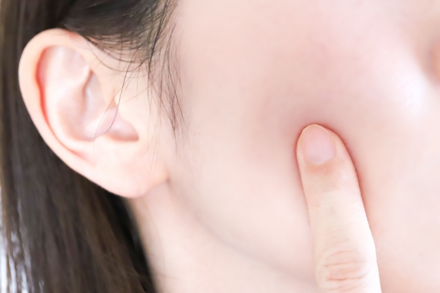 ニキビ治療で使われるイソトレチノインについてよくある質問と専門家による答えをまとめました
