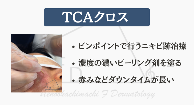 TCAクロス