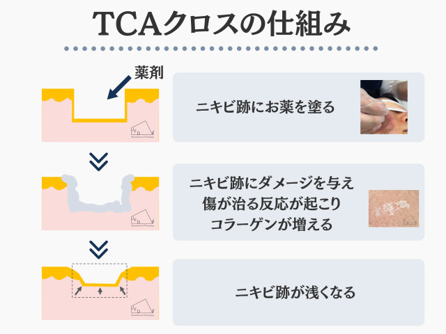 TCAクロスで期待できる効