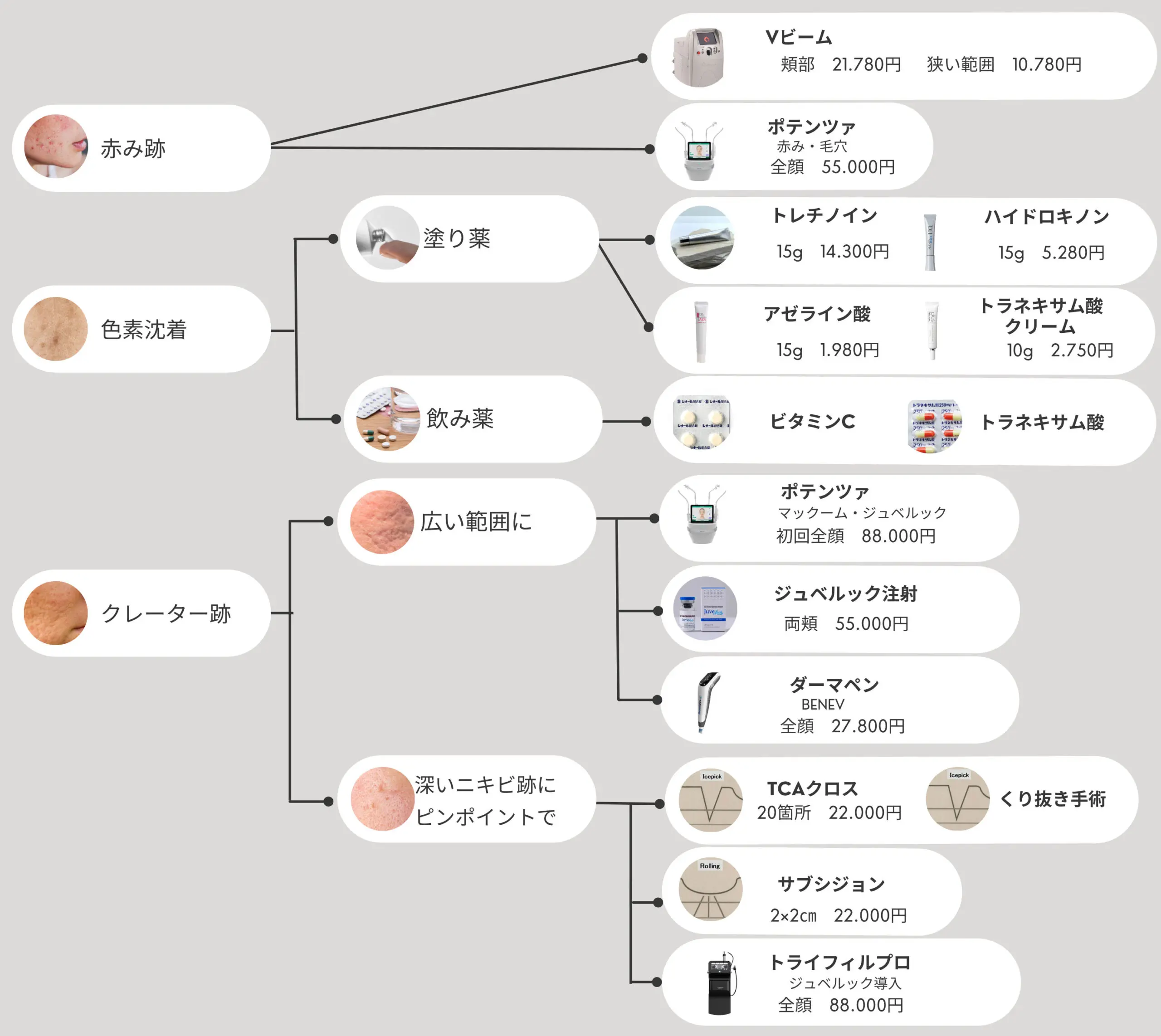 ニキビ治療一覧図