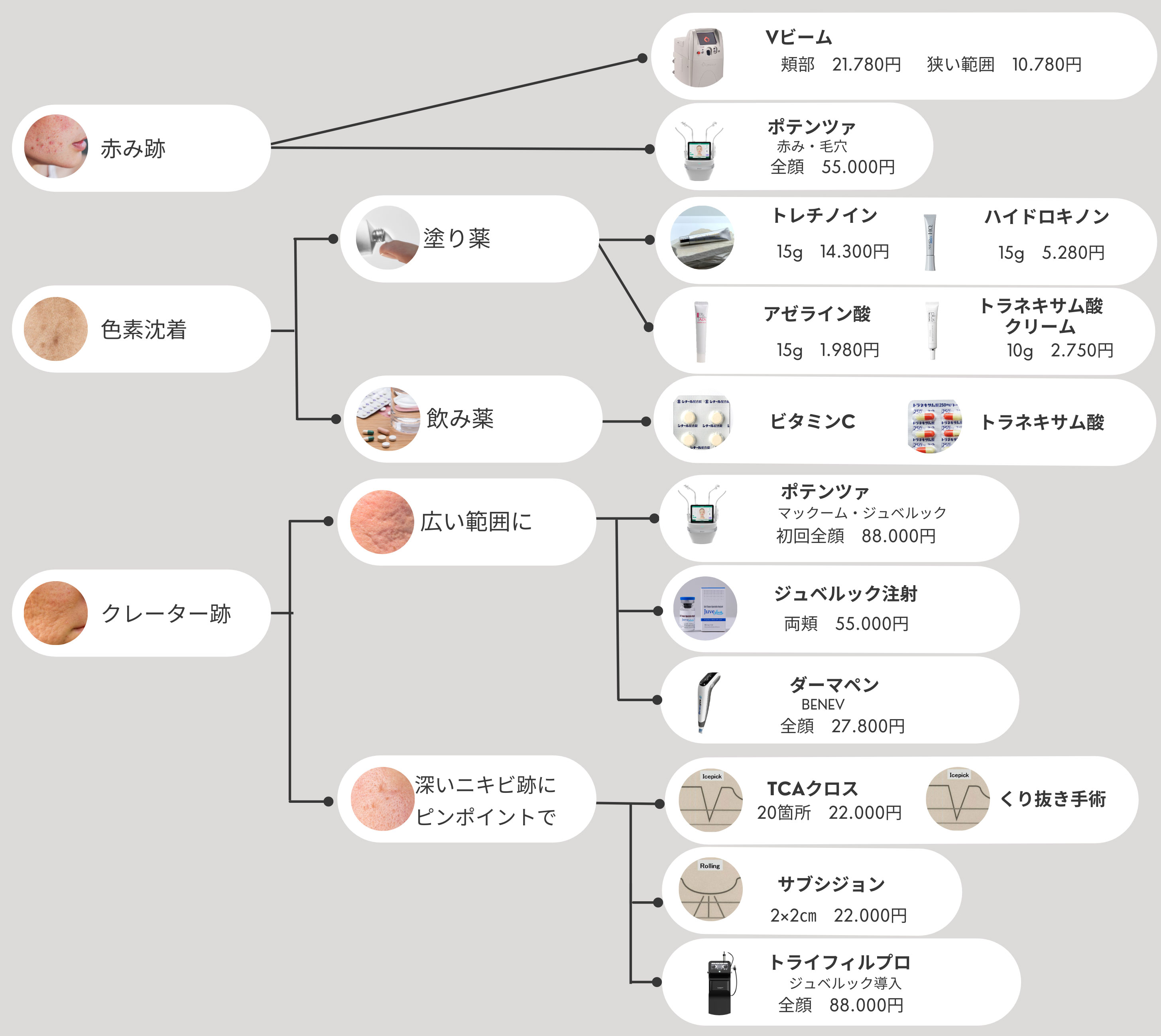 ニキビ凹み