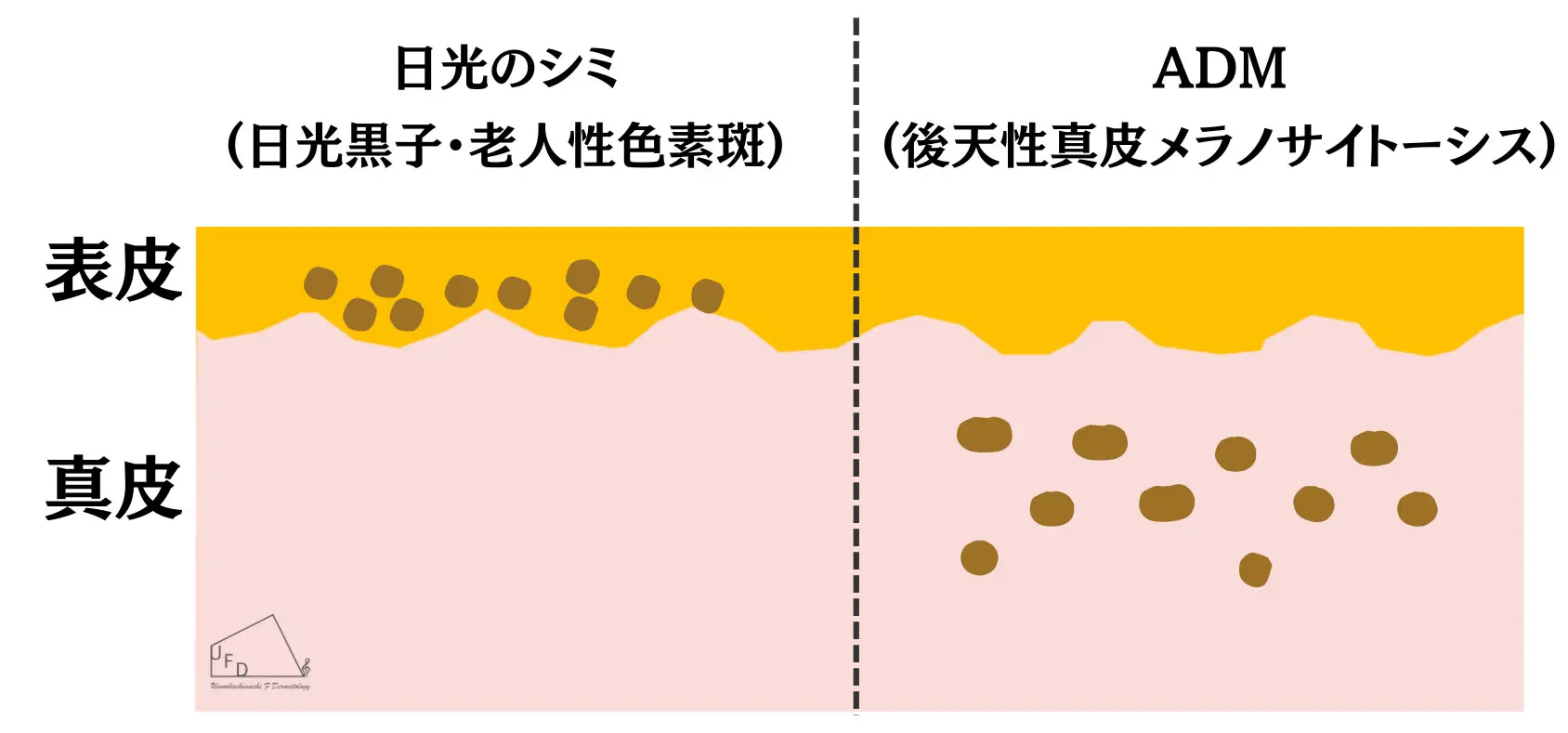 ADMの特徴