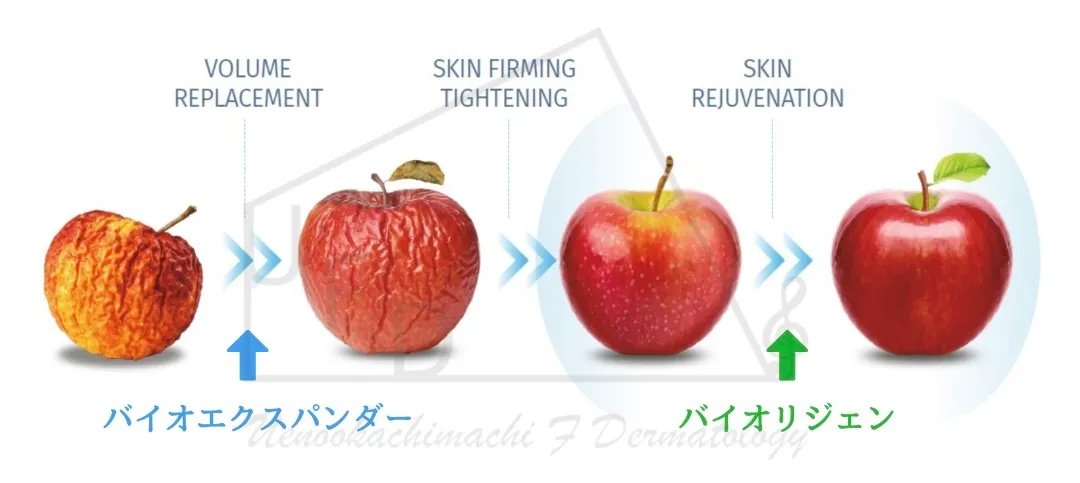 バイオリジェンとバイオエクスパンダーの使い分け