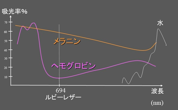 Qスイッチルビーレーザーについて