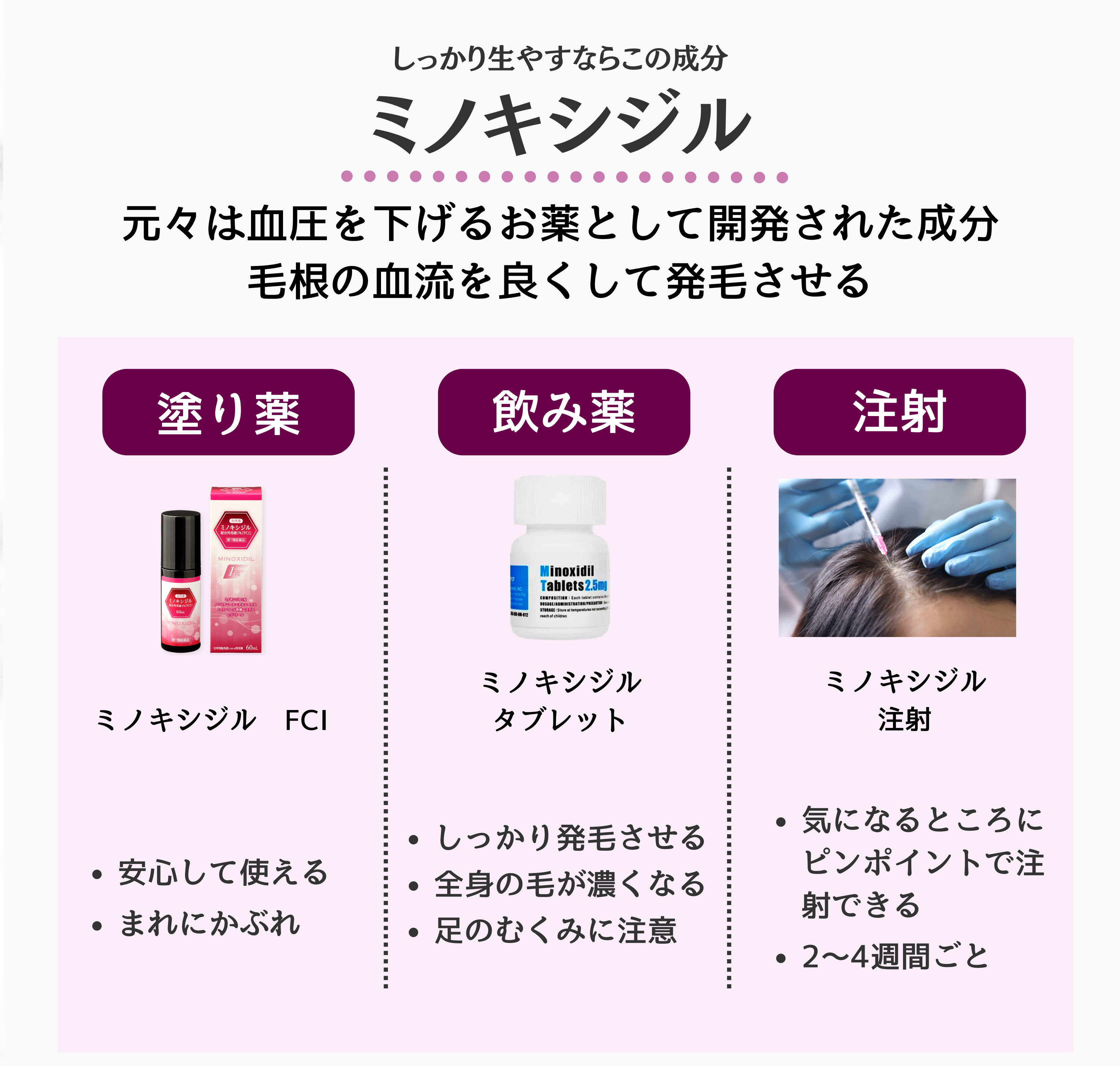 女性型脱毛症の治療