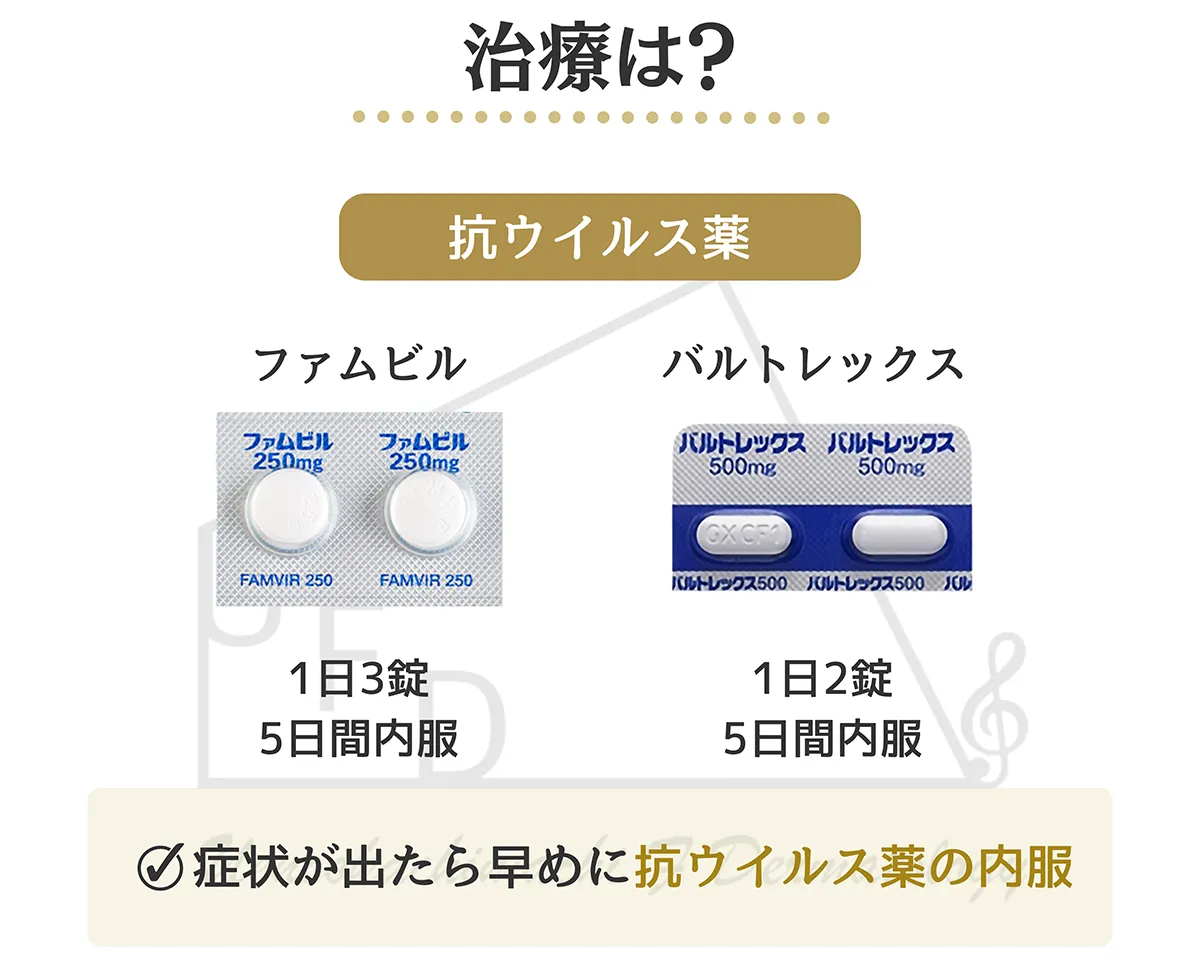 ヘルペスの治療方法