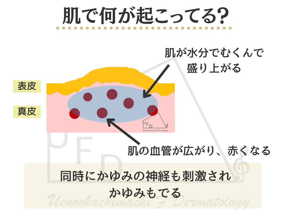 肌で起こっていること