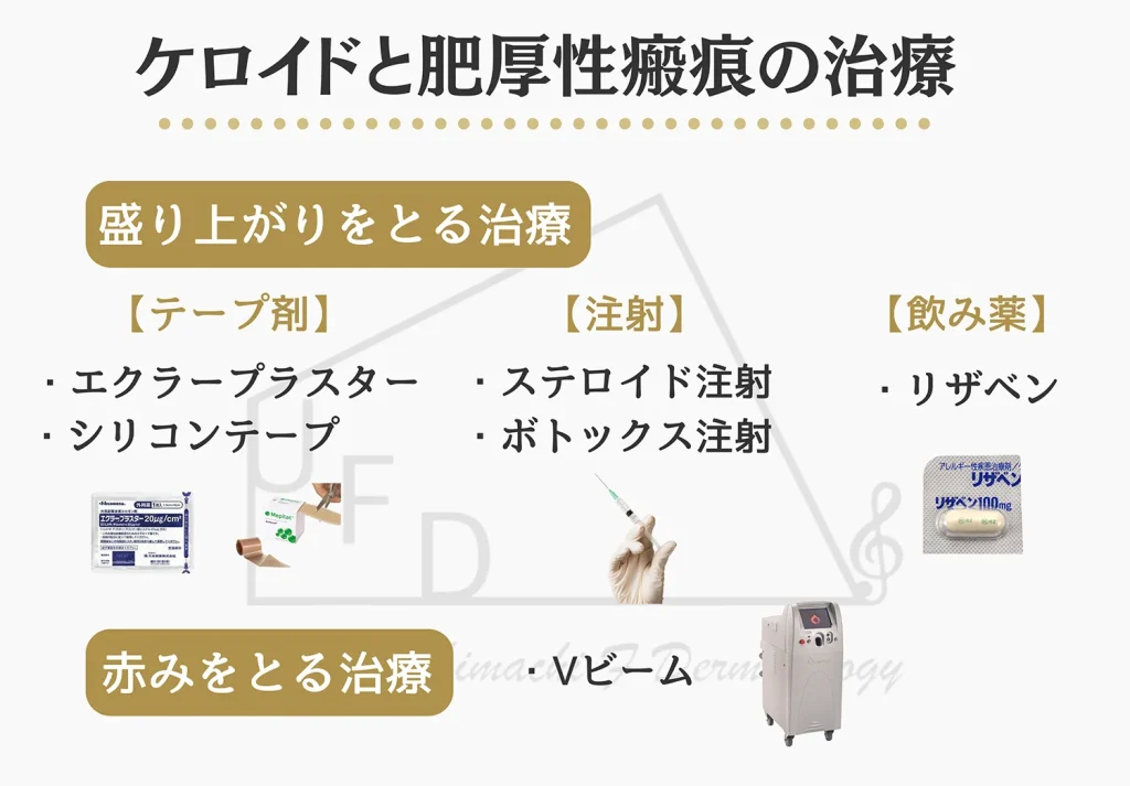 ケロイドと肥厚性瘢痕の治療について詳しく解説