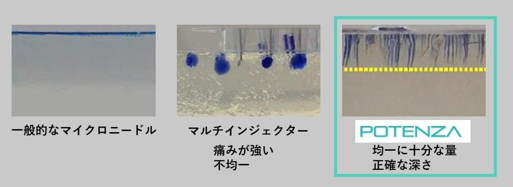 テキストが入ります