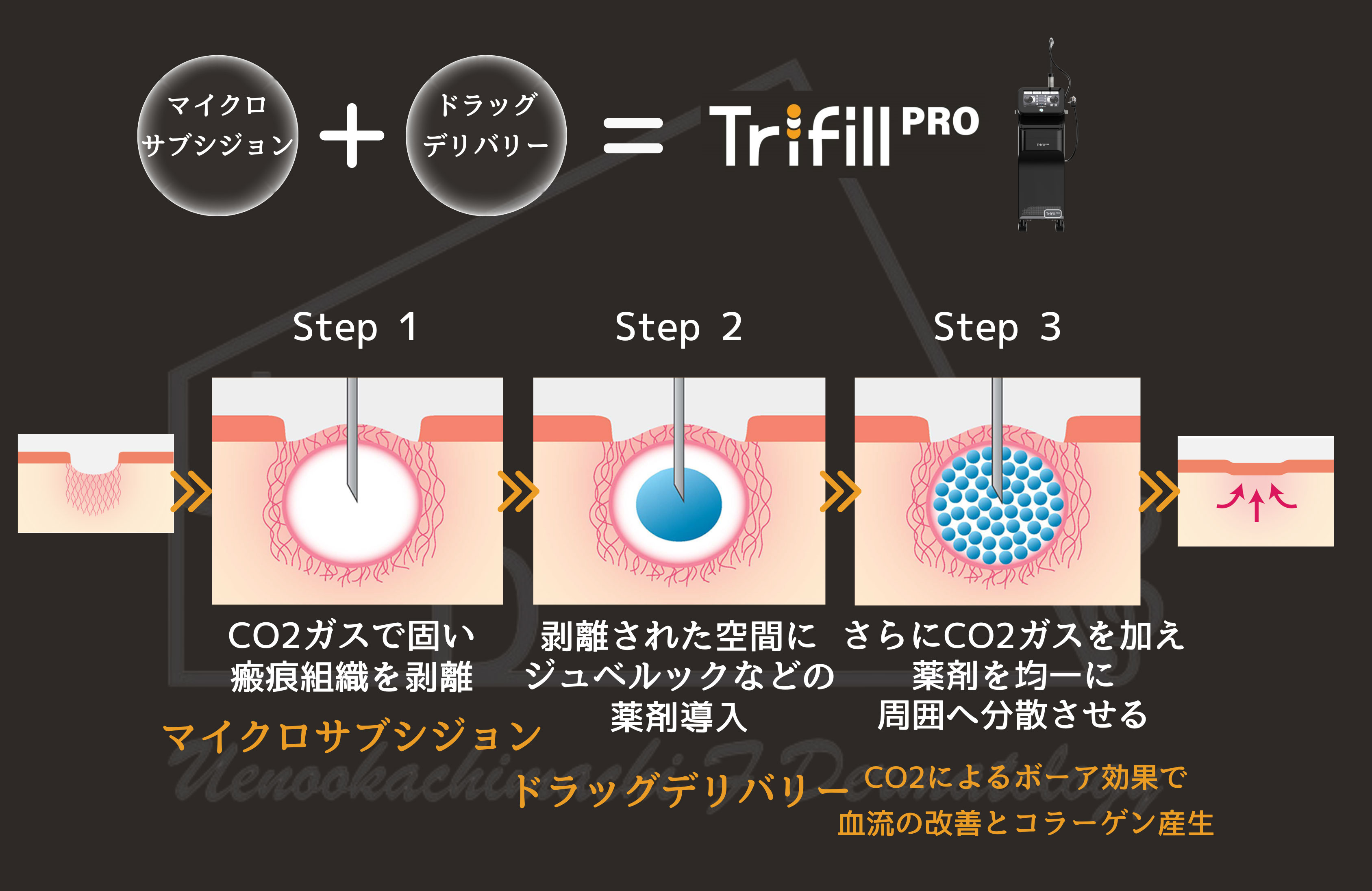 トライフィルの特徴