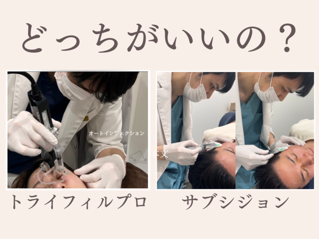 トライフィルプロ vs サブシジョン、どっちが自分に合う？違いと選び方について解説