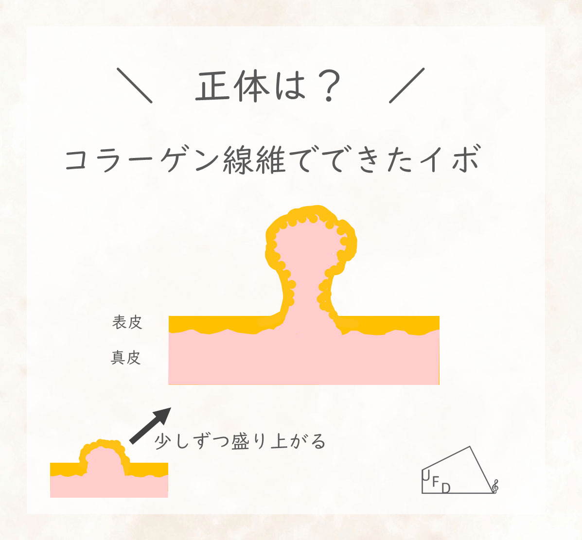首イボの正体